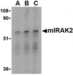 Western blot - IRAK2 Antibody from Signalway Antibody (24343) - Antibodies.com