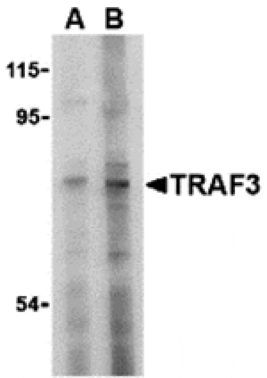 Western blot - TRAF3 Antibody from Signalway Antibody (24346) - Antibodies.com