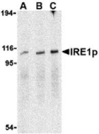 Western blot - IRE1p Antibody from Signalway Antibody (24369) - Antibodies.com