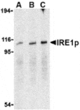 Western blot - IRE1p Antibody from Signalway Antibody (24369) - Antibodies.com