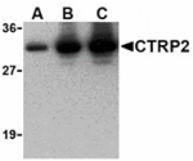 Western blot - CTRP2 Antibody from Signalway Antibody (24377) - Antibodies.com