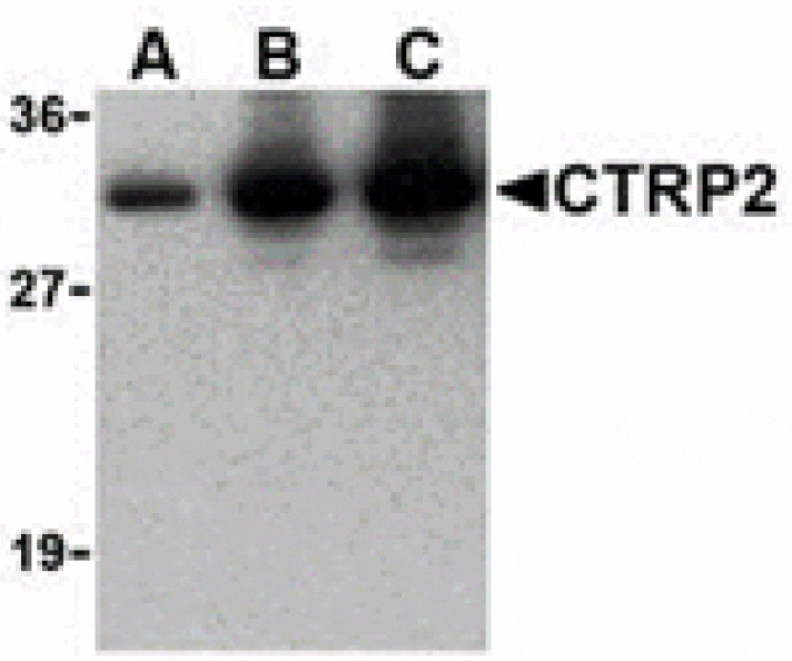 Western blot - CTRP2 Antibody from Signalway Antibody (24377) - Antibodies.com