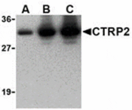 Western blot - CTRP2 Antibody from Signalway Antibody (24377) - Antibodies.com