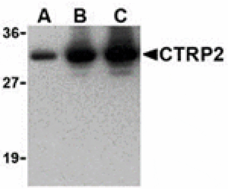 Western blot - CTRP2 Antibody from Signalway Antibody (24377) - Antibodies.com