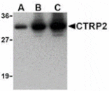 Western blot - CTRP2 Antibody from Signalway Antibody (24377) - Antibodies.com
