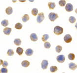 Immunocytochemistry - CTRP2 Antibody from Signalway Antibody (24377) - Antibodies.com