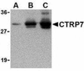 Western blot - CTRP7 Antibody from Signalway Antibody (24378) - Antibodies.com