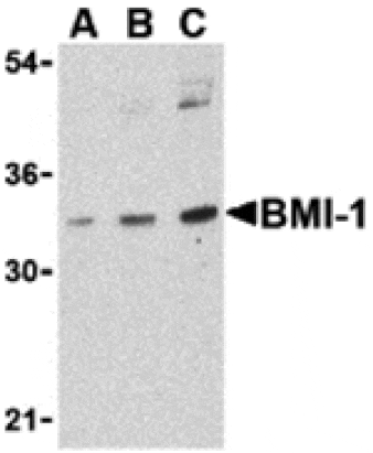 Western blot - BMI-1 Antibody from Signalway Antibody (24394) - Antibodies.com