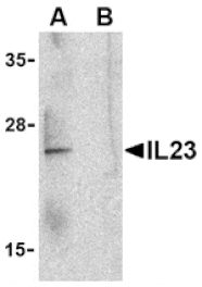 Western blot - IL-23 Antibody from Signalway Antibody (24410) - Antibodies.com