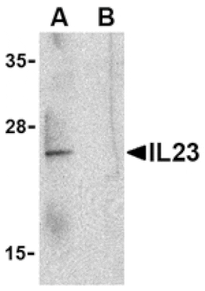 Western blot - IL-23 Antibody from Signalway Antibody (24410) - Antibodies.com