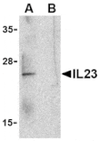 Western blot - IL-23 Antibody from Signalway Antibody (24410) - Antibodies.com