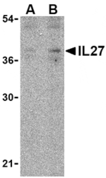 Western blot - IL-27 Antibody from Signalway Antibody (24412) - Antibodies.com