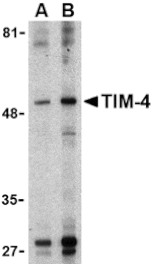 Western blot - TIM-4 Antibody from Signalway Antibody (24419) - Antibodies.com