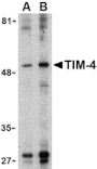 Western blot - TIM-4 Antibody from Signalway Antibody (24419) - Antibodies.com