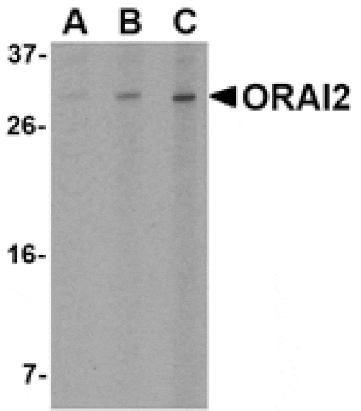 Western blot - ORAI2 Antibody from Signalway Antibody (24521) - Antibodies.com