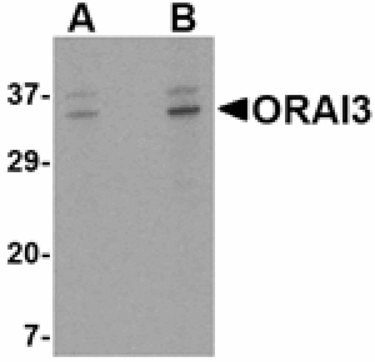 Western blot - ORAI3 Antibody from Signalway Antibody (24532) - Antibodies.com