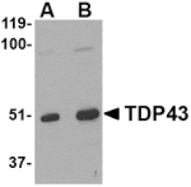 Western blot - TDP43 Antibody from Signalway Antibody (24557) - Antibodies.com