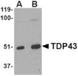 Western blot - TDP43 Antibody from Signalway Antibody (24557) - Antibodies.com