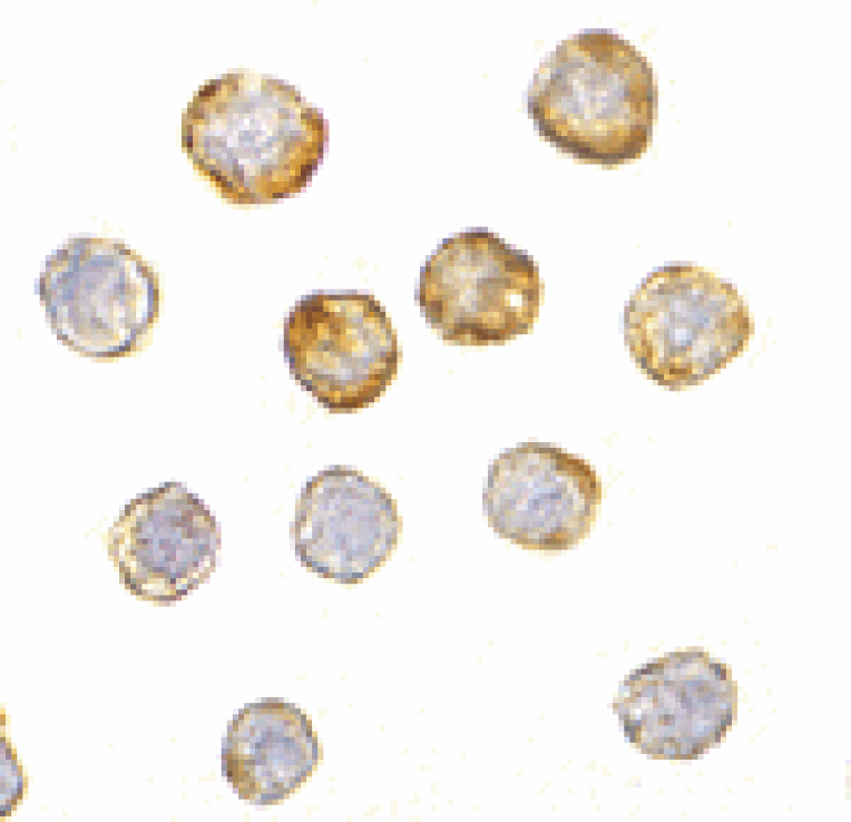 Immunocytochemistry - DISC1 Antibody from Signalway Antibody (24562) - Antibodies.com