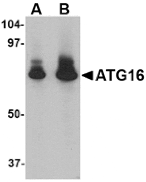 Western blot - ATG16 Antibody from Signalway Antibody (24619) - Antibodies.com