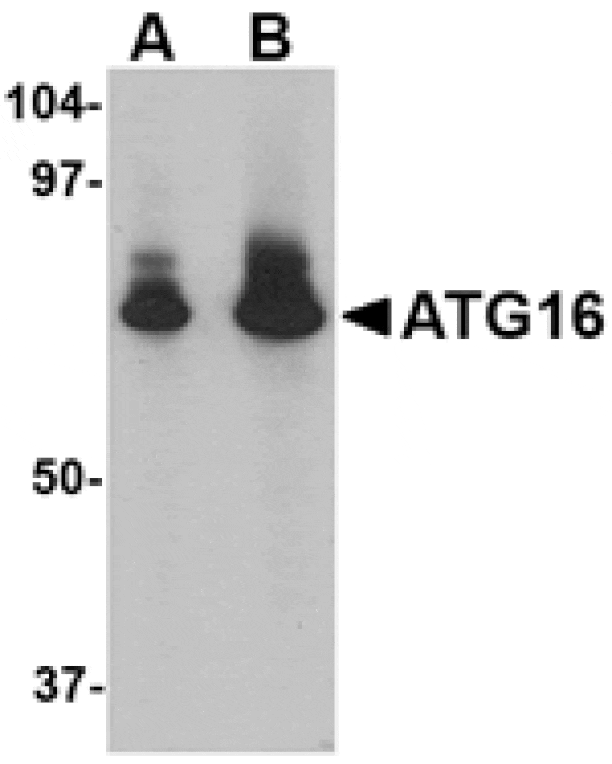 Western blot - ATG16 Antibody from Signalway Antibody (24619) - Antibodies.com