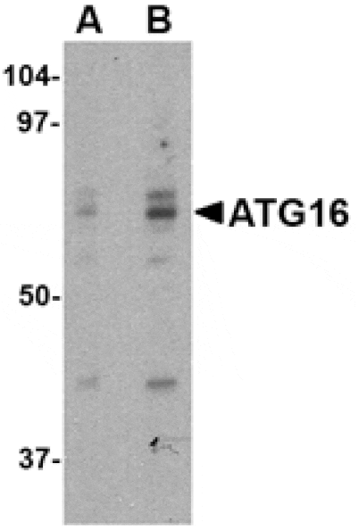 Western blot - ATG16 Antibody from Signalway Antibody (24620) - Antibodies.com