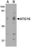 Western blot - ATG16 Antibody from Signalway Antibody (24620) - Antibodies.com