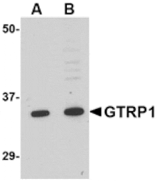 Western blot - GRTP1 Antibody from Signalway Antibody (24676) - Antibodies.com