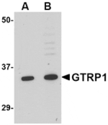 Western blot - GRTP1 Antibody from Signalway Antibody (24676) - Antibodies.com