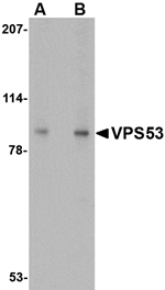 Western blot analysis of VPS53 in 293 cell lysate with VPS53 antibody at (A) 0.5 and (B) 1 µg/mL.