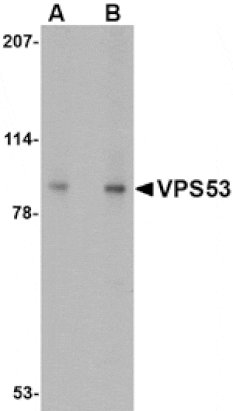 Western blot - VPS53 Antibody from Signalway Antibody (24678) - Antibodies.com