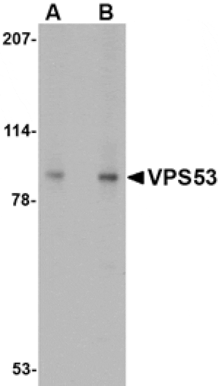 Western blot - VPS53 Antibody from Signalway Antibody (24678) - Antibodies.com