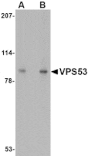 Western blot - VPS53 Antibody from Signalway Antibody (24678) - Antibodies.com