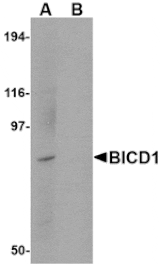 Western blot - BICD1 Antibody from Signalway Antibody (24710) - Antibodies.com
