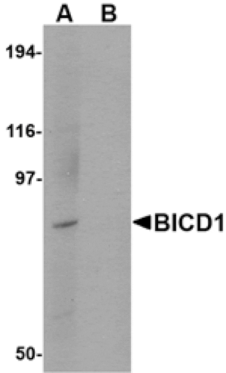 Western blot - BICD1 Antibody from Signalway Antibody (24710) - Antibodies.com