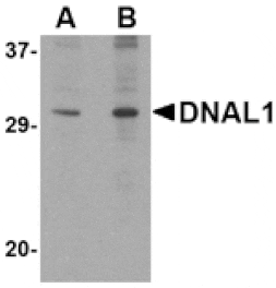 Western blot - DNAL1 Antibody from Signalway Antibody (24729) - Antibodies.com