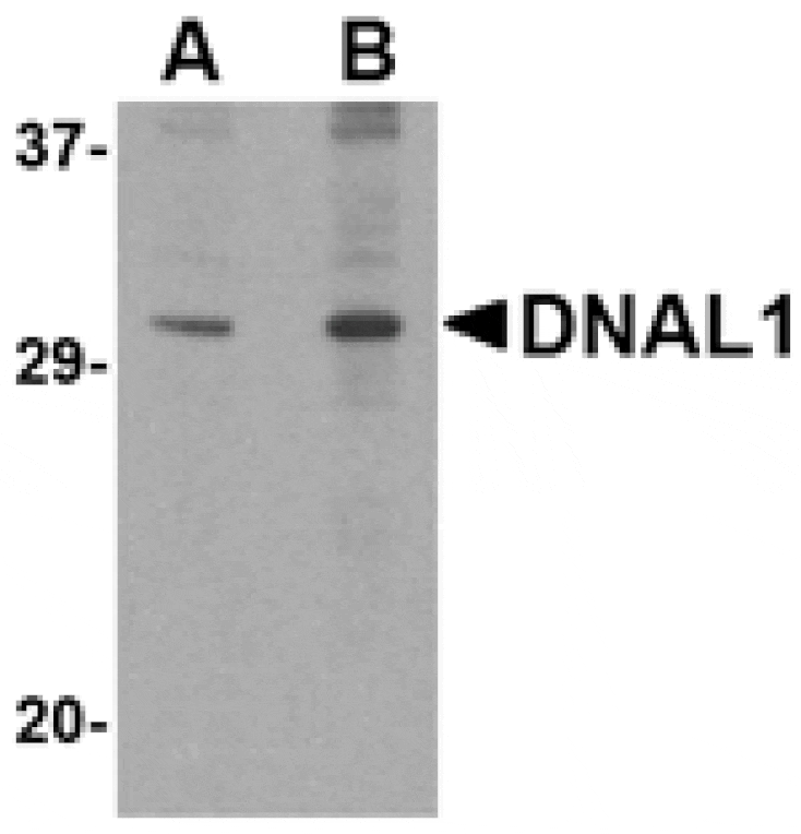 Western blot - DNAL1 Antibody from Signalway Antibody (24729) - Antibodies.com