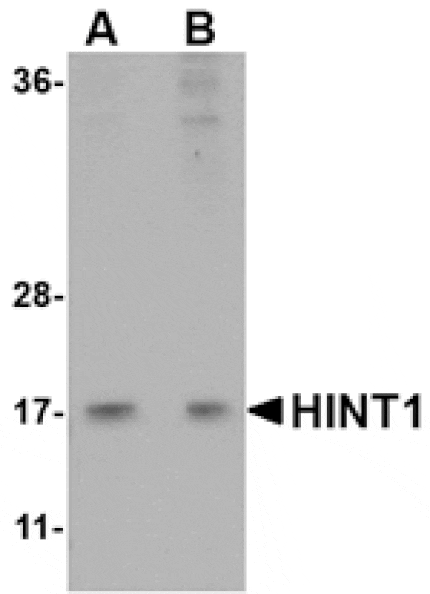 Western blot - HINT1 Antibody from Signalway Antibody (24763) - Antibodies.com