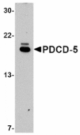 Western blot - PDCD5 Antibody from Signalway Antibody (24834) - Antibodies.com