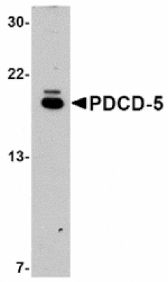 Western blot - PDCD5 Antibody from Signalway Antibody (24834) - Antibodies.com