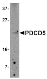 Western blot - PDCD5 Antibody from Signalway Antibody (24838) - Antibodies.com