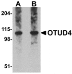Western blot analysis of OTUD4 in Daudi cell lysate with OTUD4 antibody at (A) 0.25 and (B) 0.5 µg/mL.