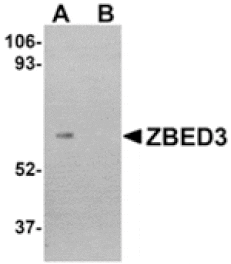 Western blot - ZBED3 Antibody from Signalway Antibody (24869) - Antibodies.com