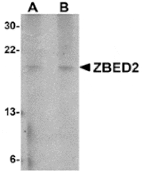 Western blot - ZBED2 Antibody from Signalway Antibody (24873) - Antibodies.com