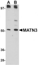 Western blot - MATN3 Antibody from Signalway Antibody (24876) - Antibodies.com