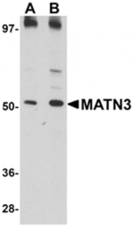 Western blot - MATN3 Antibody from Signalway Antibody (24876) - Antibodies.com