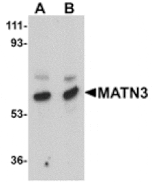 Western blot - MATN3 Antibody from Signalway Antibody (24882) - Antibodies.com