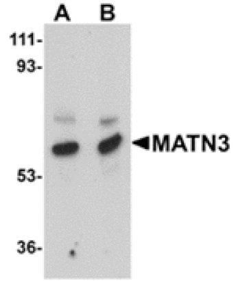 Western blot - MATN3 Antibody from Signalway Antibody (24882) - Antibodies.com