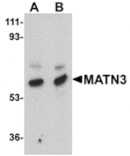 Western blot - MATN3 Antibody from Signalway Antibody (24882) - Antibodies.com