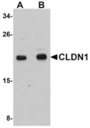 Western blot - CLDN1 Antibody from Signalway Antibody (24901) - Antibodies.com